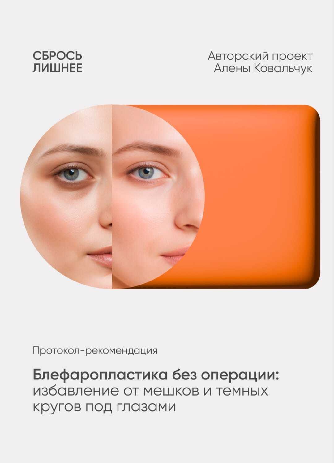 [Алена Ковальчук] Протокол-рекомендация "Блефаропластика без операции" (2025)
